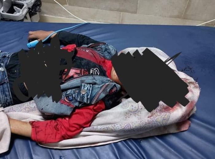 مقتل طفل في اشتباكات مسلحة غربي إب