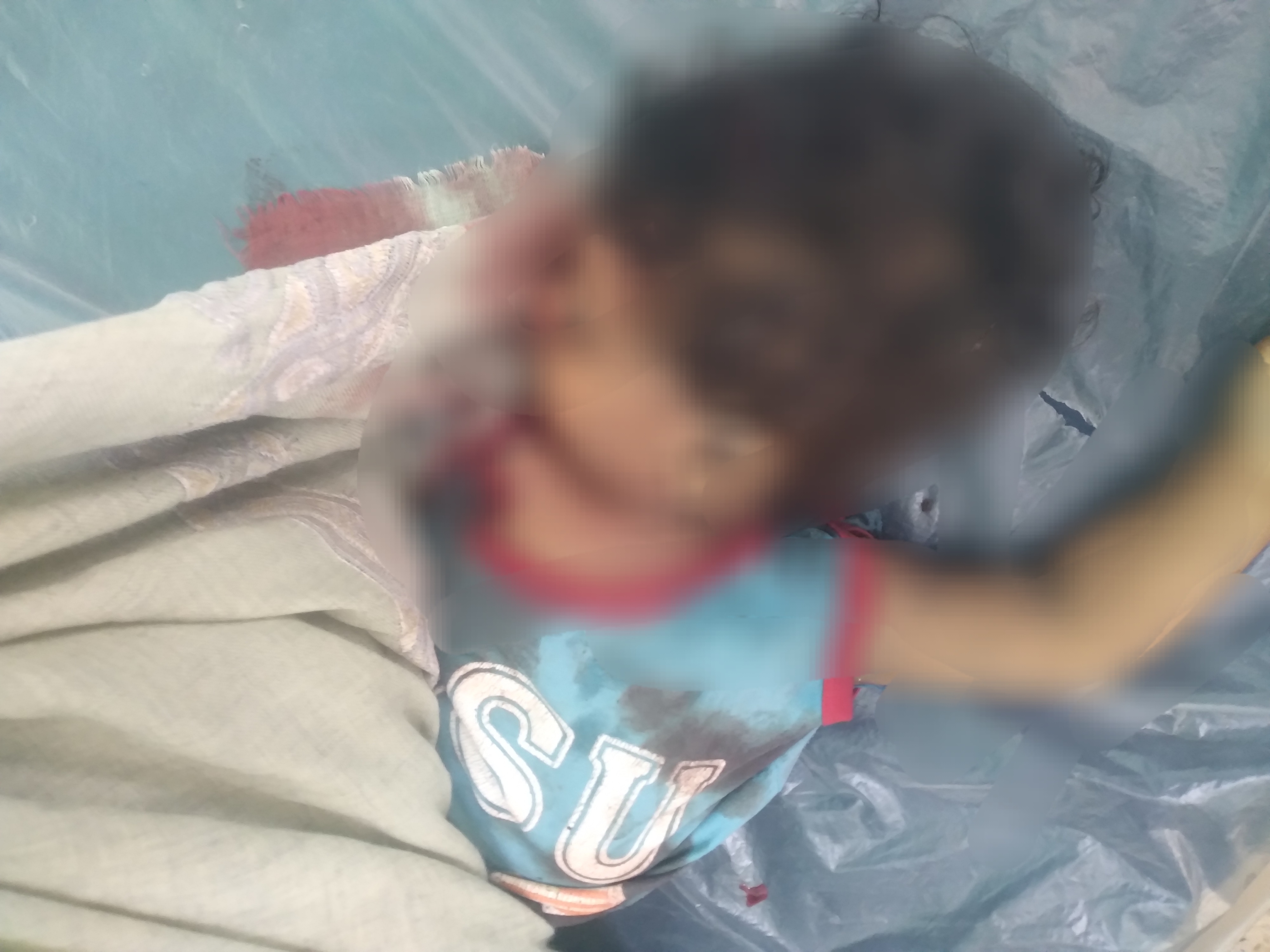 مُسيرة حوثية تقتل طفلة بعمر سنة ونصف جنوبي تعز