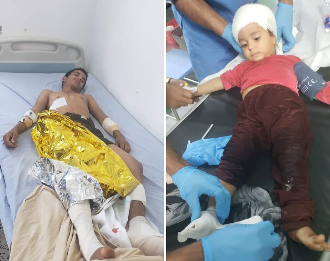 انفجار مقذوف حوثي يصيب ثلاثة أطفال من أسرة واحدة في الضالع